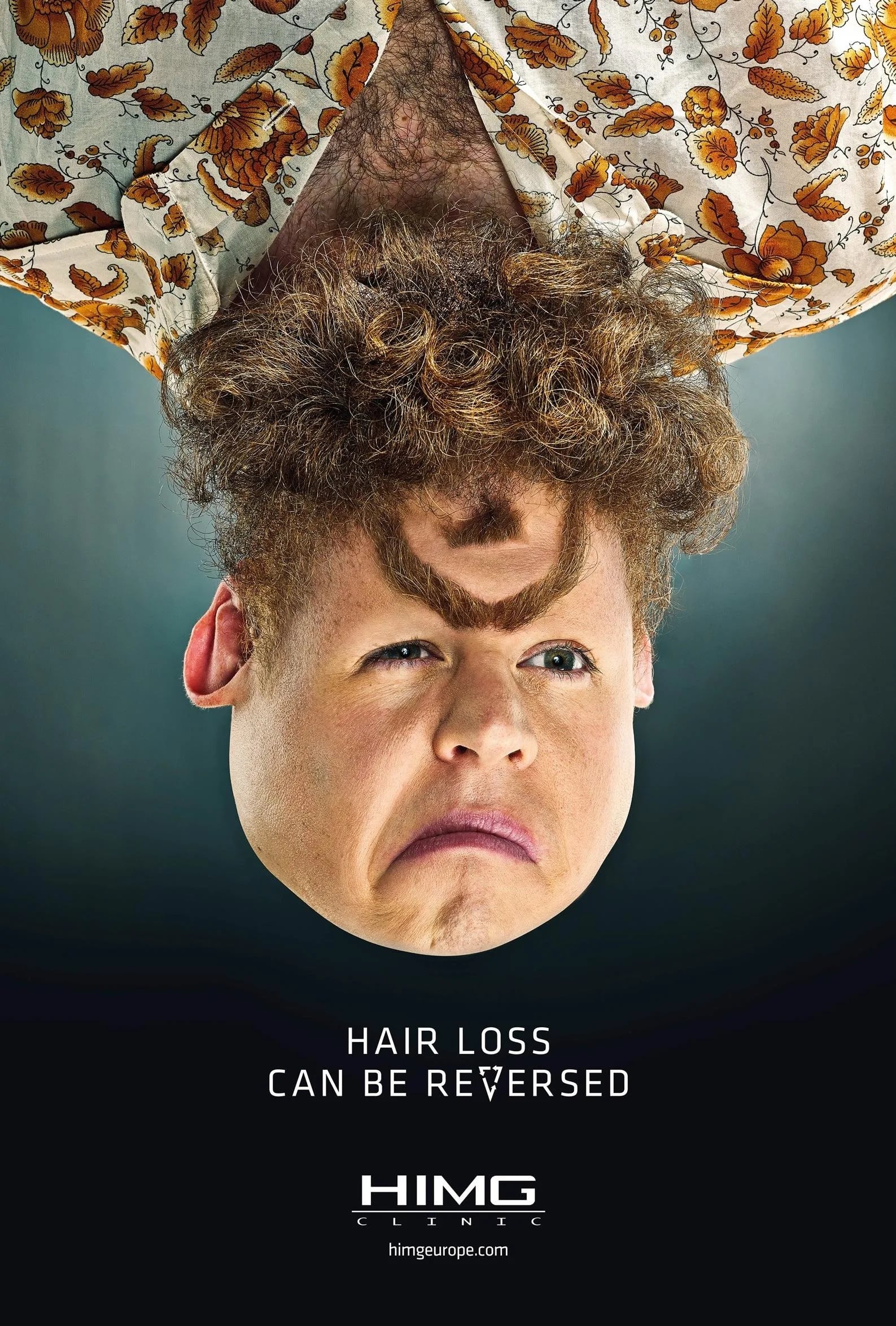 imagem hair loss